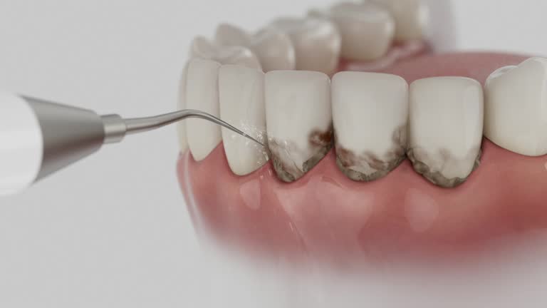 Trusted Emergency Dentist service in Tustin, CA - Dentist Open Now